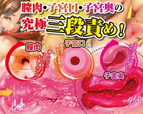 å­å®®å§¦é ååèª¬æç»å3